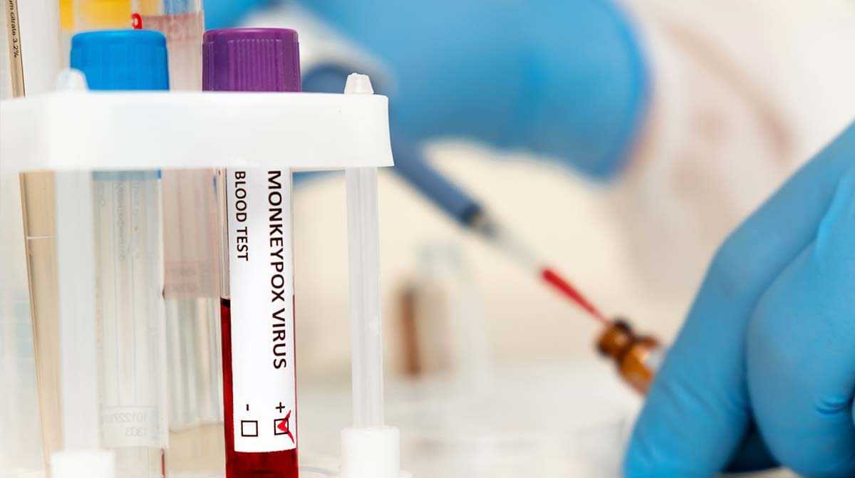 How HR Departments Prepare for Monkeypox